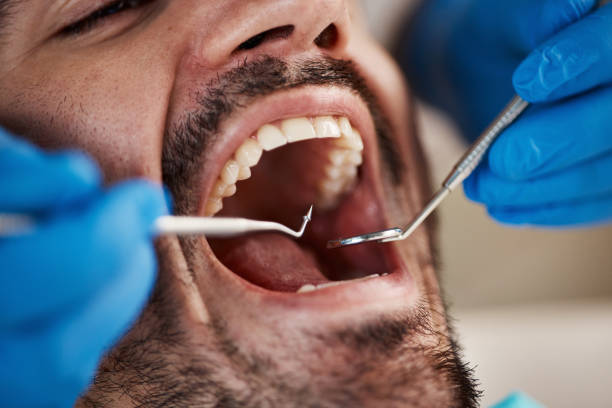 Best Knocked-Out Tooth Emergency  in Lewistown, MT